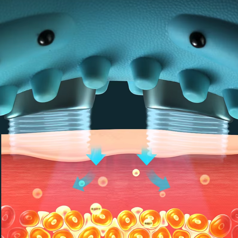 Vitalspine Smartneck Plus - Neck Massager